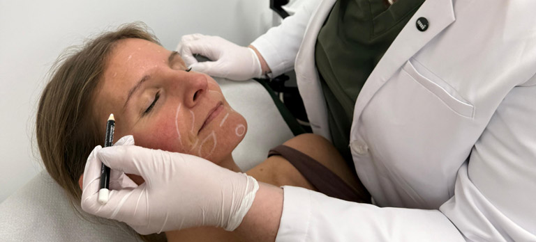dermal fillers